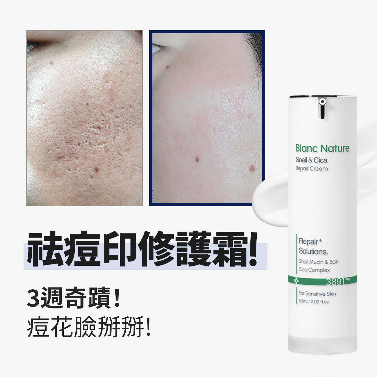 Blanc Nature 蝸牛經典修護霜 60ml